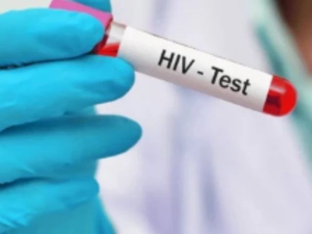 Total HIV cases among children rise to 80 as preteen, toddler test positive at Karachi’s KBV hospital
